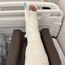 209.서울병원_2 | 부주상골증후군 SNU 서울병원 수술 후기 2탄(병원밥, SNU 서울병원 입원 후기)