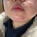 안일빌딩 | 청주 여드름 압출 1등은 여기 복대동 뉴욕비비 청주점 (영업시간, 예약 방법, 압출 후기 등)