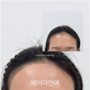 뷰티왁싱