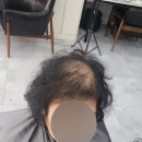 김호증모가발다온헤어