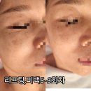 너반뷰티에스테틱 네이버블로그
