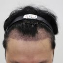 압구정맘모스헤어라인의원 이미지