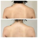 대림문구 | 대림피부관리실 MJ뷰티에서 거북목 굽은 등관리 후기