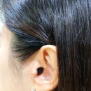 스마일보청기 이미지