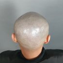 일러스라인 이미지