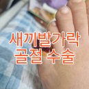 새양산유치원 | [질병.상해] 7세 유아 새끼발까락 골절 수술과정 그리고 골절 회복 과정 이야기