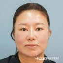 휴고성형외과의원 이미지