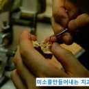 보람치과기공소 이미지