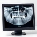 하남본치과의원 | 드디어 미루던 숙제 끝냄! 연세 굿 프 란 트 치과 솔직 후기