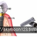 정DENTAL 티스토리