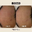 더 맑은 스킨 무안오룡점