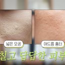 로담