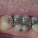 예치과기공소 이미지