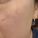 장미꽃과 나이팅게일 피부과의원 이미지