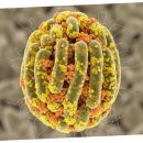 경화반점 이미지