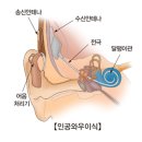와우히어링 이미지