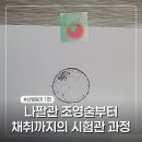 의료법인의인의료재단차병원 | 난임 일기 #1. 나팔관 조영술, 과배란 주사 그리고 첫 채취까지의 여정(조영술 통증 강도, 초음파 난포...
