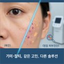 나의미래피부과의원 | 양천구피부과추천(진료과목: 피부과) 후기만 믿고 결정하면 안 되는 이유