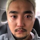 거울공주 - 강진군 시장길 19 | 킴카다시안 시술 울산 피부과 자가혈 줄기세포 피부주사 정맥주사 효과, 후기