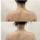 뮤르에스테틱 | 분당 윤곽관리&뼈말라관리 리얼 후기| 뮤르에스테틱