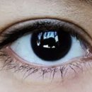 눈이 뿌옇게 보이는 증상 갑자기 눈이 뿌옇게보임 이유 원인 ? 이미지