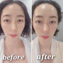 용카인테리어 | 동탄 2 피부 관리 - 호수공원 엘리움 스파 1:1 용카 얼굴 마사지 후기