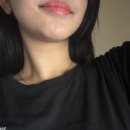 샤프(SHARP)성형외과의원 | 신논현 샤프 성형외과 1년 후기