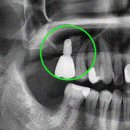 동탄가온치과의원 이미지