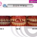 e-플랜트치과 이미지