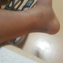 차딱지