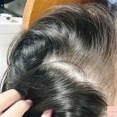 하이스칼프 | 피디하이 하이옴 올커버 스칼프 케어 토닉 두피쿨링 제대로 되는 두피토닉