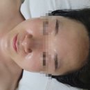 [후기] 대전 피부관리 더맑은스킨 대전관저점 대만족 후기