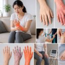 군포정형외과의원 | 부위 통증 증후군(CRPS) 완전 가이드 — 군포·당정역·군포역·당동 근처에서 CRPS 원인·치료·관리...