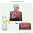 기흉 진단비(태아가입형) 특별약관[2025년 1월 1일부터 적용] 이미지