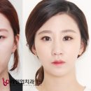 수림치과의원 네이버블로그