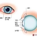 결막염 전염 (유행성 결막염, 알레르기성 결막염) 이미지