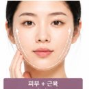이레모터스 | 고양 피부과 리프팅 네오페이스 효과, 누구에게 좋을까?