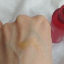 아크네 이미지