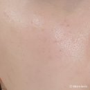 영팩토리 | 올리브영 추천템 더마팩토리 나이아신아마이드 20% 모공세럼 후기