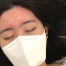 석헤어라인 네이버블로그