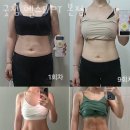 센츄리헬스 이미지