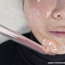 인천 가정동 기미제거 미작뷰티검단점에서 아라동미백잡티 기미관리 받은 리얼 후기