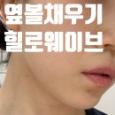 웨이브 온 | 강남 피부과에서 힐로웨이브 받고온 시술 후기