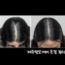 도치도트 탈모 두피케어 속눈썹 | 제주탈모커버 티 나지 않는 자연스러운 정수리 채움 제주시청 온결 뷰티 1탄