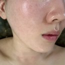 경락효과 유지기간 솔직한 전후 사진으로 비교해본 나띠르스킨 부산 윤곽관리 후기