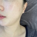 아우라케어 | 대구피부관리샵 아우라미용학원 워터테라피 스킨케어 후기