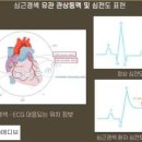 메디브로 이미지