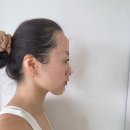 알기 쉬운 생활풍수 | 울산 피부과 브이로리프팅 효과, 통증, 붓기 루비스타레이저 흑자 제거 후기