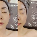 [목동 에스테틱 추천] 끌리메 작은 얼굴 윤곽관리 솔직후기