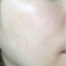 [진심 후기] 락토바실러스 플랜타럼 유산균, 피부로 증명된 10년의 신뢰 : 정**** 2025-07-15 이미지